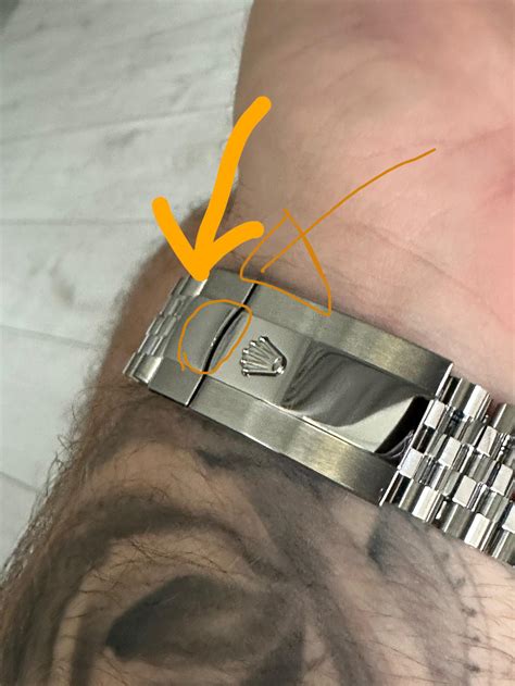 rolex clasp scratches.